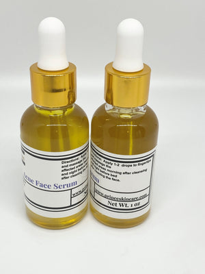 Acne Face Serum